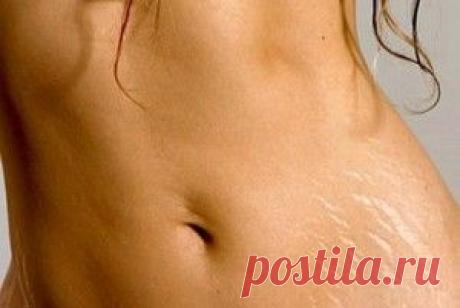 Мумие от растяжек. Рецепт крема от растяжек с мумие, лечение растяжек, отзывы.