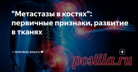 "Метастазы в костях": первичные признаки, развитие в тканях Здравствуйте, уважаемые читатели!
Онкология костной системы — не самая часто встречающаяся форма. В костях опухоли злокачественного типа образовываются уже на поздних этапах рака, который изначально локализовался в каком-то другом органе.
Поэтому обычно рак опорно-двигательного аппарата - это вторичная разновидность онкологии. Раковые новообразования заносятся в кости из главного очага с кровью и