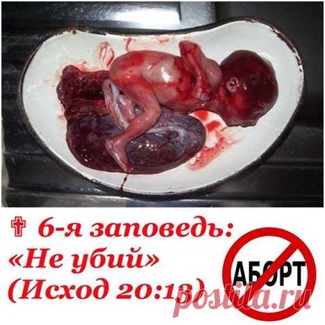 «Лепта за жизнь» - помогите спасать детей от смерти! Сбор подписей ЗА запрет абортов! — православная социальная сеть Елицы