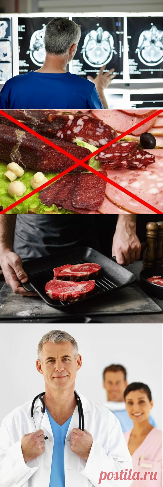 Ученые выяснили, употребление какого мяса защищает от слабоумия
  Лучше отдавать предпочтение свежей говядине или баранине, а не колбасе. К указанным выводам пришли исследователи из Университета Лидса (Великобритания), проанализировав данные о питании и состоянии здоровья почти 500 тысяч британцев в возрасте от 40 до 69 лет. Информация об этих людях собиралась в среднем на протяжении восьми лет. За это время деменция разного типа […]
Читай дальше на сайте. Жми подробнее ➡