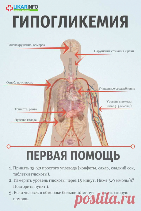 Гипогликемический обморок при диабете: что делать?