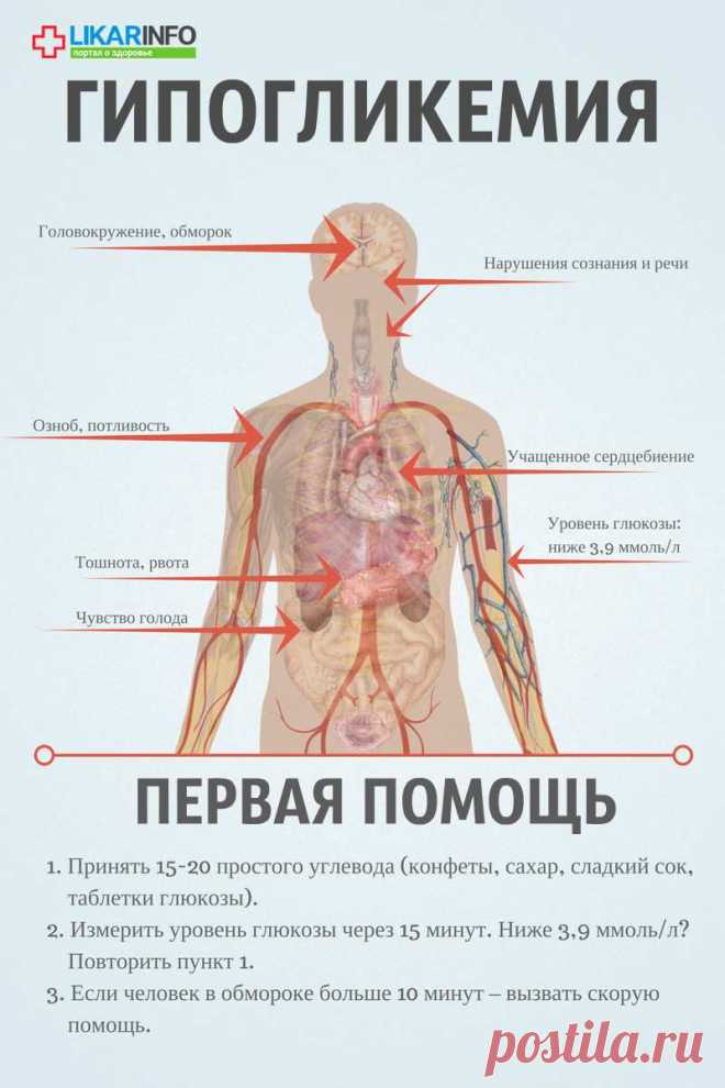 Гипогликемический обморок при диабете: что делать?