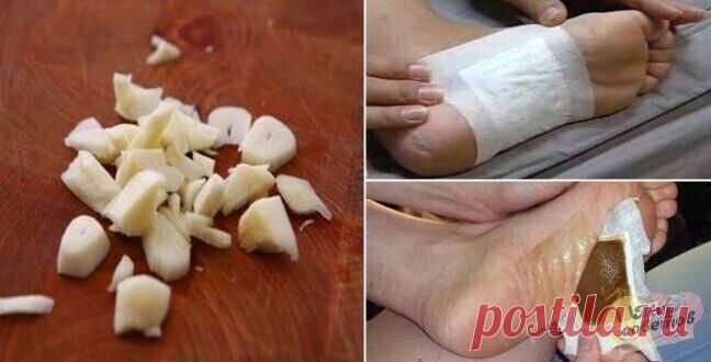 ЭТО МОЩНЕЙШАЯ ДЕТОКСИКАЦИЯ ВСЕГО ОРГАНИЗМА ВО ВРЕМЯ СНА!
Даже мой врач не удержался и взял рецепт!

Это очень простой, но невероятно эффективный метод для вывода токсинов из организма. Вывод токсинов происходит через кожу стоп во время сна.

Это своего рода компресс, который закрепляется на подошвах ног и находиться в таком положении на протяжении сна.

Сила здоровья и красоты в натуральных рецептах! 

Из-за загрязненной окружающей среды, неправильного питания, химических ...