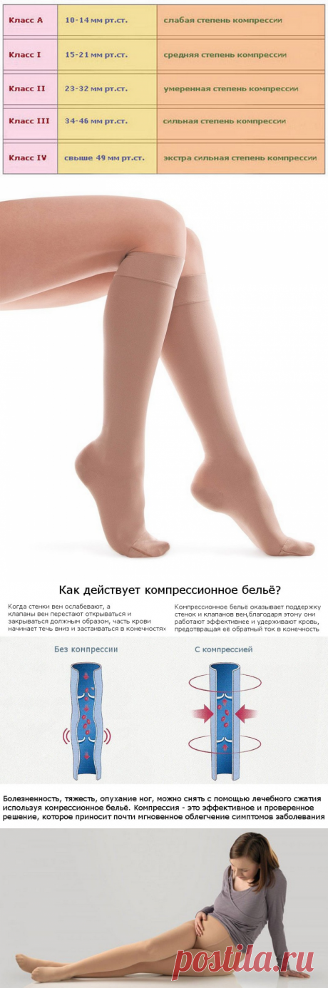 Медицинский компрессионный трикотаж - классы компрессии