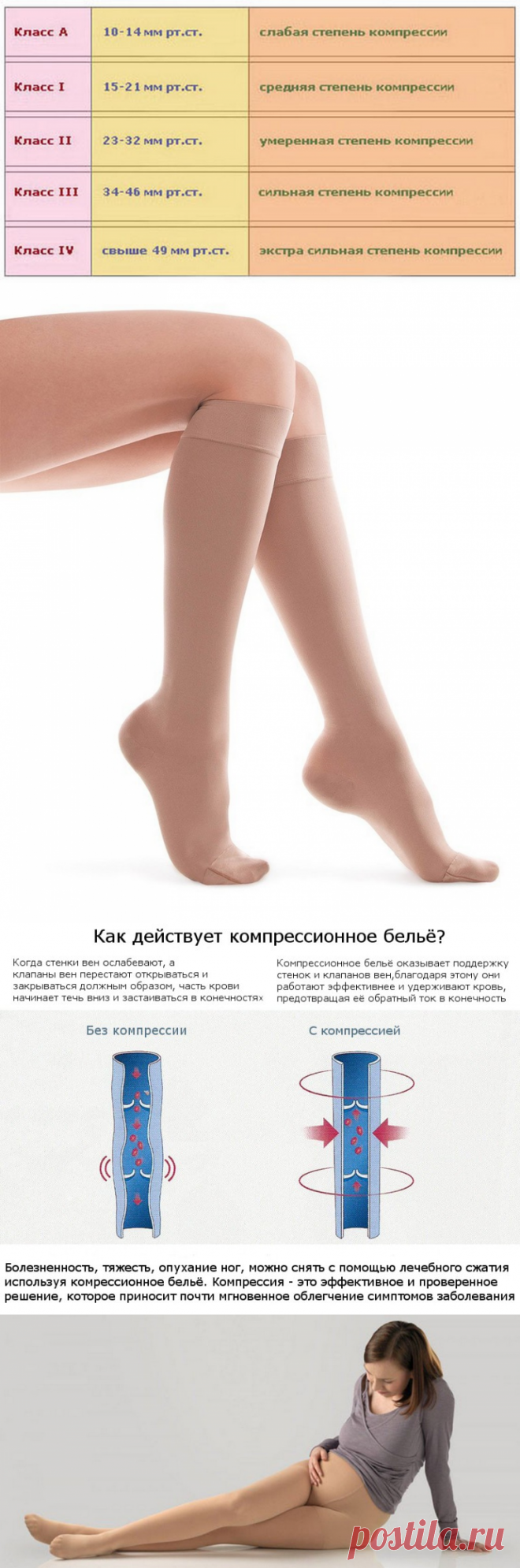 Медицинский компрессионный трикотаж - классы компрессии