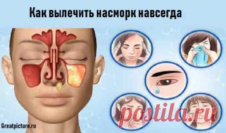 Как вылечить насморк навсегда.Лечатся даже запущенные формы! Как вылечить насморк навсегда: Симптомы простуды преследуют нас практически в любой сезон. Самый неприятный и назойливый из них – насморк