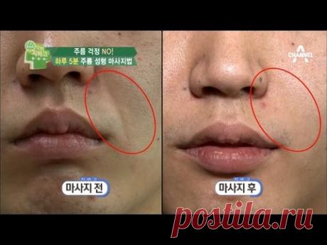 1cm만 줄어도 6살 동안 효과를? ‘팔자주름 마사지법’_채널A_닥터지바고 51회