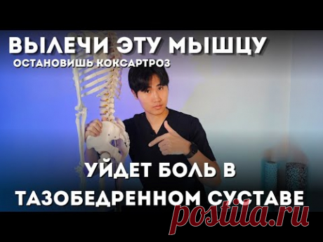 УПРАДНЕНИЯ ДЛЯ ТАЗОБЕДРЕННОГО СУСТАВА
