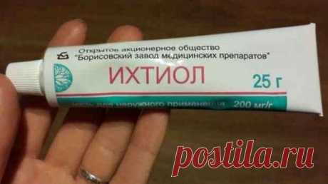 Средство надежное — ихтиоловая мазь. Спасает от многих бед, хоть и стоит недорого. Купите, пусть будет в аптечке | Люблю Себя Ихтиоловая мазь – проверенное временем лекарство, эффективность которого была известна еще в начале позапрошлого века, а во время первой мировой войны — это лекарство, продающееся сегодня без рецептов в любой из аптек, спасло немало солдат от гангрен и ампутаций. Ихтиоловая мазь показана к применению при таких заболеваниях: Гидраденит (гнойное воспа...
