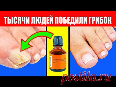 Вылечить Грибок на Ногах. Дешевое Средство от Грибка Ногтей