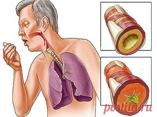 СПОСОБ ОЧИСТИТЬ ЛЕГКИЕ
- 1 небольшой кусочек корня имбиря;
- 2 чайные ложки куркумы;
- 1 литр воды;
- 400 г чеснока (очищенного, и порезанного на дольки);
- 400 г сахара (может быть обычным, но в идеале — коричневый).
Нагрейте воду в кастрюле. Когда она закипит, добавьте в нее сахар, чеснок, имбирь и куркумы.
Сахар добавляйте последним.
Варите смесь на медленном огне до тех пор, пока не выкипит половина воды. Потом снимите кастрюлю с плиты и перелейте жидкость в банку. Ког...