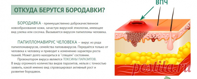 Аллокин альфа при лечении вируса папилломы. Как вывести бородавки на руках