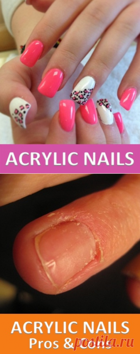 Pros and Cons of Acrylic Nails | Virtual Clinic