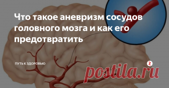 Что такое аневризм сосудов головного мозга и как его предотвратить Аневризма сосудов  головного мозга – это заболевание, при котором в сосудах возникает  образование. Уплотнение способно увеличиваться в размерах. Как? Оно  наполняется кровью. Сама по себе аневризма не опасна. Единственное – она  давит на ткани. Но безопасно уплотнение только до момента разрыва.
После  разрыва внутрь тканей мозга попадает кровь. Подобный процесс называют  кровоизлиянием. Но только