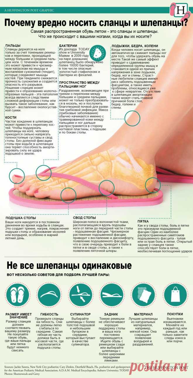 Почему вредно носить сланцы и шлепанцы / Surfingbird - проводи время с пользой для себя!