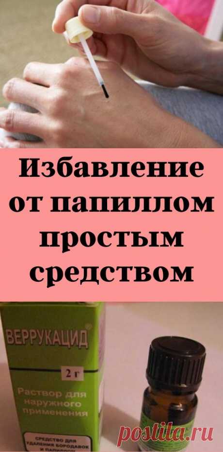 Избавление от папиллом простым средством