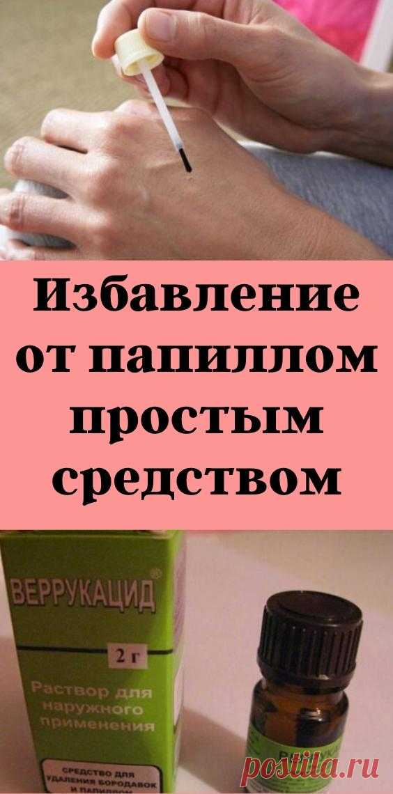 Избавление от папиллом простым средством