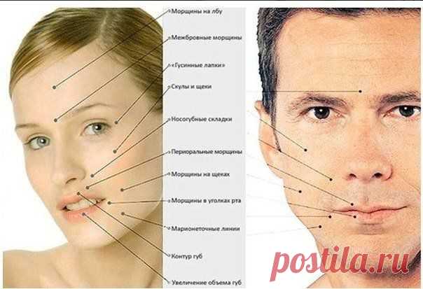 О чем говорят морщины на лице