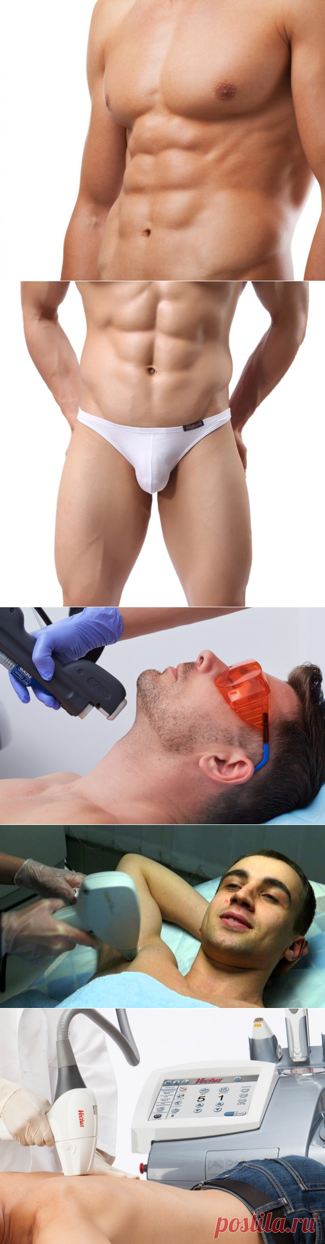 Лазерная эпиляция для мужчин: отзывы, плюсы и минусы, особенности процедуры