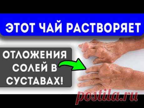 Рецепт дала знакомая знахарка… 8 продуктов от солей в суставах