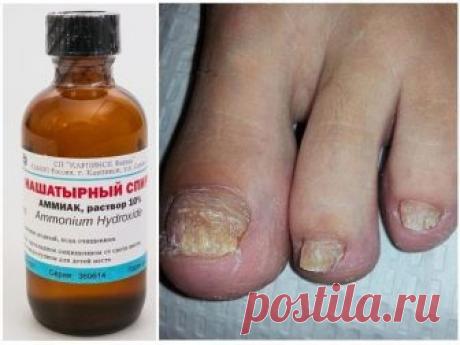 ТРИ РЕЦЕПТА ЛЕЧЕНИЯ ГРИБКА НА НОГТЯХ
1 ложку нашатырного спирта необходимо развести в стакане воды.
В этом растворе необходимо смочить любую ткань, но только не синтетическую. Этой тряпкой необходимо обернуть пораженный палец, наверх надеть целлофановый пакет, а затем носок.
Эти действия необходимо повторить в течение 5 дней, после чего грибок исчезнет.
Можно приготовить мазь из сырого куриного яйца, 1 столовой ложки уксуса, 1 столовой ложки растительного масла и 1 чайной ...
