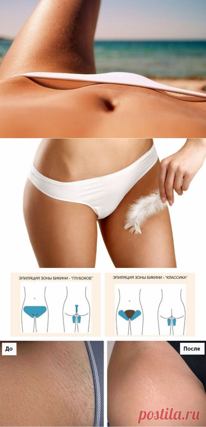Эпиляция глубокого бикини: фото