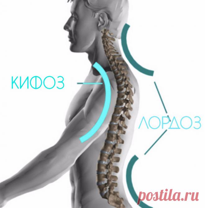 Что такое гиперлордоз и чем он опасен Привлекательный прогиб в области поясницы — мечта всех девушек. Но очень немногие знают, что чрезмерный прогиб в данной зоне — это патологическое состояние позвоночника, которое называется гиперлордоз.