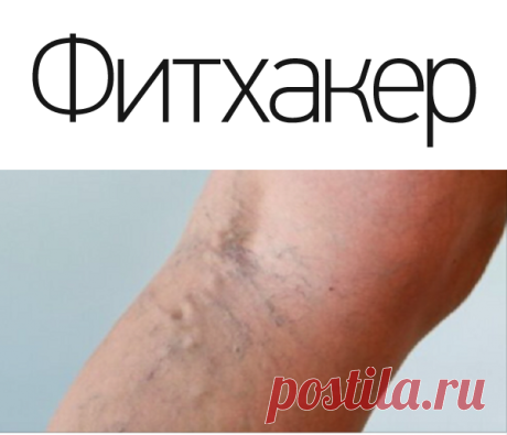 Эфирное масло, которое лечит варикозные вены, боль в мышцах, прыщи и многое другое