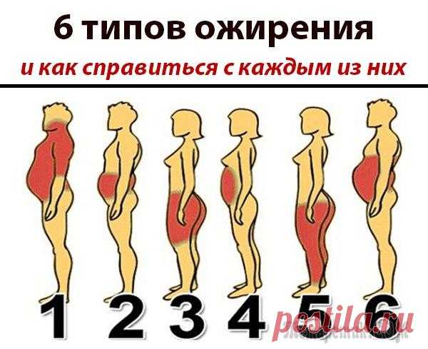 6 ТИПОВ ОЖИРЕНИЯ. КАК СПРАВИТЬСЯ КАЖДЫМ ИЗ НИХ