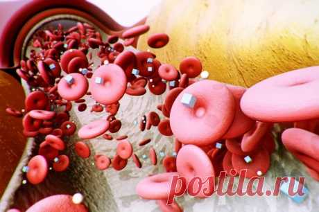 Что такое МЕТАБОЛИЧЕСКИЙ СИНДРОМ и кто в зоне риска? Aif.ru отвечает на популярные вопросы читателей.