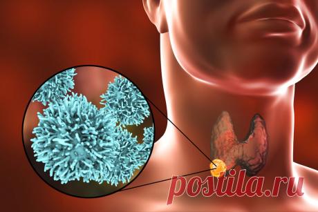 Рак щитовидной железы: очевидные признаки
Щитовидная железа располагается у основания шеи человека и играет важную роль в его организме. Одни из основных функций этого органа: — участие в регулировании сердечного ритма; — контроль за AD. И сбои в работе щитовидки сказываются на здоровье самым негативным образом. А еще щитовидная железа подвержена новообразованиям, в том числе злокачественным. Как же достоверно определить […]
Читай дальше на сайте. Жми подробнее ➡