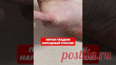 Пятки гладки! Народный способ!