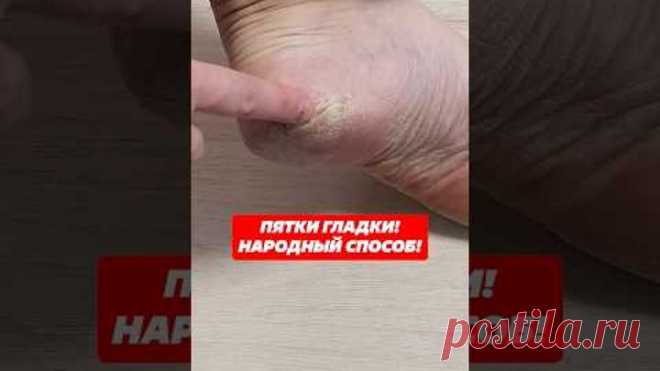 Пятки гладки! Народный способ!