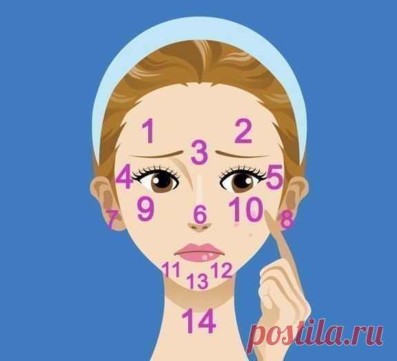 Карта прыщиков и как с ними бороться | Хитрости Жизни