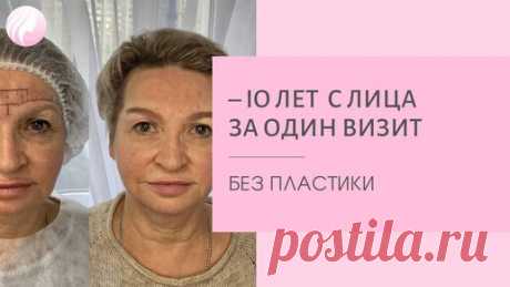 Перманентный макияж бровей возвращает молодость! | Татьяна Фенева | АРЕОЛЫ| РУБЦЫ | ПЕРМАНЕНТ | Дзен