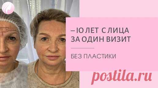 Перманентный макияж бровей возвращает молодость! | Татьяна Фенева | АРЕОЛЫ| РУБЦЫ | ПЕРМАНЕНТ | Дзен