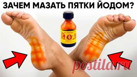 Йодную сетку, наносят на ступни ног ватной палочкой в виде тоненькой решетки с ячейками 1 х 1 см. Это позволит улучшит кровообращение и избавиться от отёка ног. Йод повышает защитные функции организма. Поэтому такая сетка полезна при насморке, если нет возможности попарить ноги.

Все должны помнить о том, что йод является важным элементом для человеческого организма. Он контролирует работу многих органов и прямо воздействует на здоровье человека.