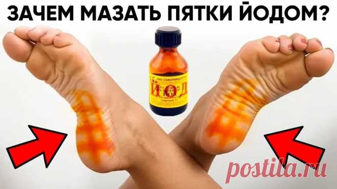 Йодную сетку, наносят на ступни ног ватной палочкой в виде тоненькой решетки с ячейками 1 х 1 см. Это позволит улучшит кровообращение и избавиться от отёка ног. Йод повышает защитные функции организма. Поэтому такая сетка полезна при насморке, если нет возможности попарить ноги.

Все должны помнить о том, что йод является важным элементом для человеческого организма. Он контролирует работу многих органов и прямо воздействует на здоровье человека.