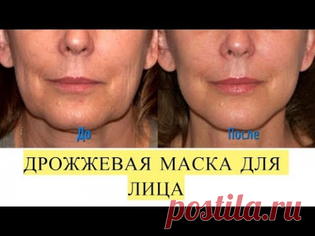 Как быстро омолодить лицо на 5-10 лет без шприца и скальпеля.