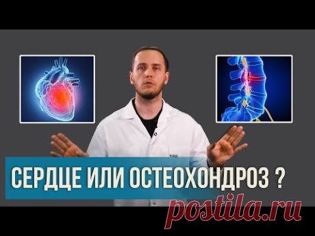 Боль в грудной клетке: СЕРДЦЕ или ОСТЕОХОНДРОЗ? | Раскладываем все по полочкам | Доктор Епифанов