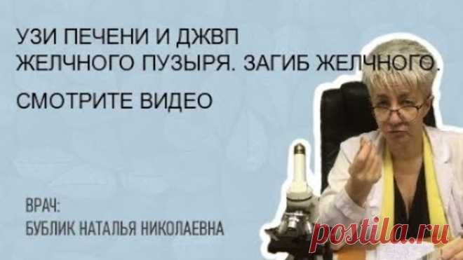 УЗИ ПЕЧЕНИ и ДЖВП желчного пузыря. Загиб желчного. Бублик Наталья Николаевна 8(950)0330055.