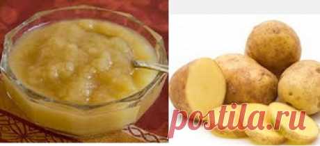 Картофельно-яблочная маска для молодой и красивой кожи - Упражнения и похудение Это лучше, чем любой антивозрастной крем, который вы когда-либо встретите Картофель — это хорошо известный ингредиент для красоты. Это натуральный отбеливающий агент, который также используется для усиления свечения кожи. Эту маску для лица, вы можете использовать, чтобы получить молодую и красивую кожу Возьмите натертый картофель Добавьте две-три столовые ложки яблочной мякоти Смешайте все Нанесите пасту на …