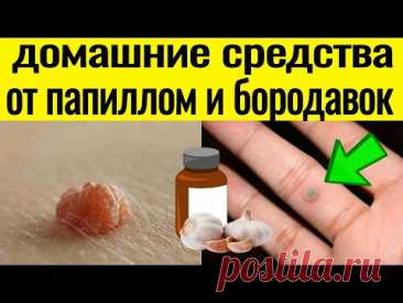 ИЗБАВЬСЯ ПРОСТО и БЕЗОПАСНО от ПАПИЛЛОМ и БОРОДАВОК в домашних условиях !!!