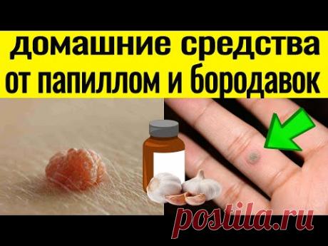 ИЗБАВЬСЯ ПРОСТО и БЕЗОПАСНО от ПАПИЛЛОМ и БОРОДАВОК в домашних условиях !!!