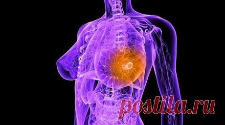 Кратко о молочных железах &amp;laquo;  Будь Здоров