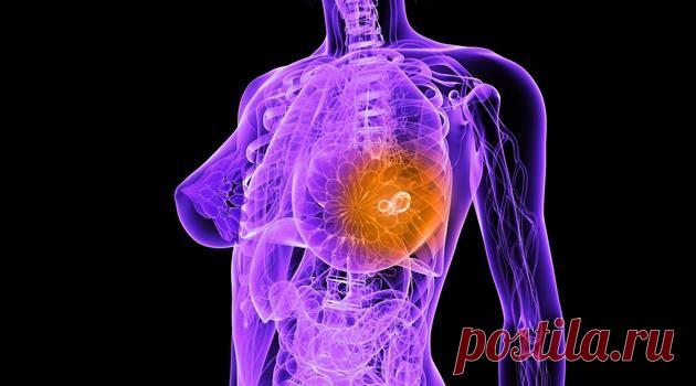 Кратко о молочных железах &laquo;  Будь Здоров