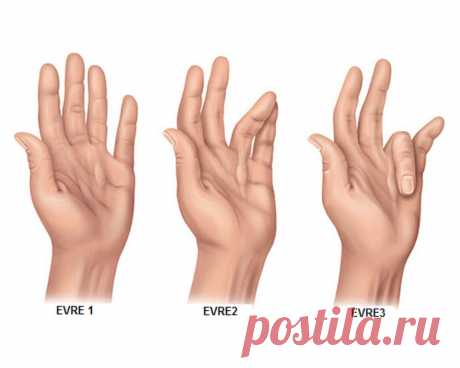 : Потяните себя за указательный палец 20 секунд. : Потяните себя за указательный палец 20 секунд. 
 
Существует целая наука, которая называется рефлексология и изучает биоактивные точки, расположенные на ладони (так же, как на стопе и на ухе) и управляющие всем организмом. 


Большой палец: беспокойство, головные боли, Большой палец, словно якорь, несет ответственность за все решения. Он тесно связан с эмоциями человека, а именно с беспокойством, депрессией, повышенной тре...