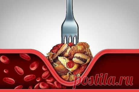 ОЧИЩАЕМ СОСУДЫ ОТ ХОЛЕСТЕРИНА | OK.RU