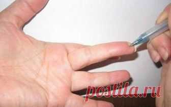 Особая точка на пальце - СОХРАНИ! УБОЙНЫЙ РЕЦЕПТ!  

  Если тебе не просто плохо, а хреново, надави на точку и держи долго. Снижает резко давление,  нормализует многие вещи.  Сознание проясняется, в глазах станет ясно.  В ушах - на грани звона.  

  Этим пользуются в военной медицине.  А там лечение от обычной сильно отличается.  Там экстремальная медицина. Там нужно делать все быстро, быстро восстановить, быстро остановить,  быстро поднять на ноги.  

  Точка находится на...