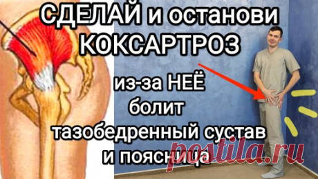 Сделай и останови КОКСАРТРОЗ / из-за этой мышцы болит тазобедренный сустав и поясница + перекос таза | ✅ ГРИГОРИЙ ИГНАТЬЕВ | ЛФК | Дзен